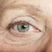 huidveroudering rond de ogen