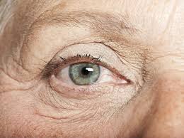huidveroudering rond de ogen