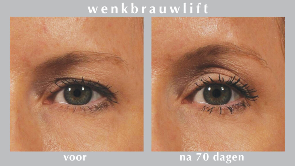 natuurlijke wenkbrauwlift | All About Beauty