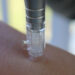 microneedling mesotherapie