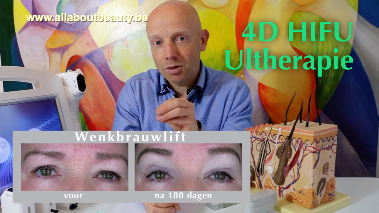 Video Natuurlijke facelift met Hifu Ultherapie