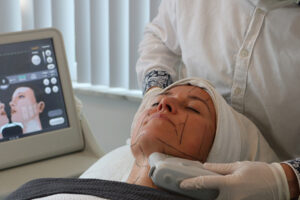 Natuurlijke facelift Ultherapie Hifu behandeling Huidverjonging met HIFU